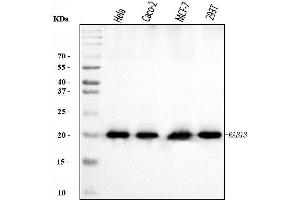 Western blot analysis of RAB13 using anti-RAB13 antibody (ABIN7600599).