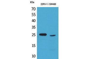 Western Blotting (WB) image for anti-Synovial Sarcoma, X Breakpoint 2B (SSX2B) (C-Term) antibody (ABIN3178216) (Synovial Sarcoma, X Breakpoint 2B (SSX2B) (C-Term) Antikörper)