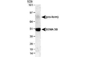 Western blot analysis of SEMA3B in mouse E16 cerebellum lysate with SEMA3B polyclonal antibody . (SEMA3B Antikörper  (AA 100-200))