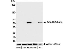 Western Blotting (WB) image for anti-Tubulin, beta 3 (TUBB3) (AA 400-450) antibody (ABIN7453957)