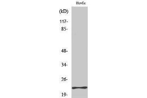 Western Blotting (WB) image for anti-Myosin, Light Chain 3 (MYL3) (Internal Region) antibody (ABIN3185728) (MYL3/CMLC1 Antikörper  (Internal Region))