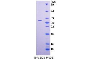 SDS-PAGE analysis of Human POLa1 Protein.