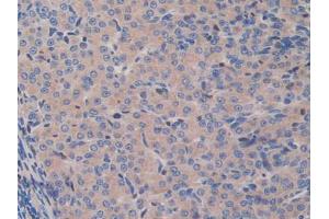 IHC-P analysis of Mouse Ovary Tissue, with DAB staining. (GAB3 Antikörper  (AA 142-375))