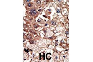 Immunohistochemistry (IHC) image for anti-Epidermal Growth Factor Receptor Pathway Substrate 8 (EPS8) antibody (ABIN3003718) (EPS8 Antikörper)