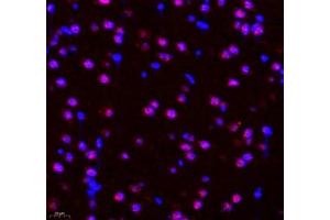 Immunofluorescence of paraffin embedded rat brain using PRPF3 (ABIN7075311) at dilution of 1: 2200 (400x lens) (PRPF3 Antikörper)