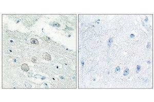 Immunohistochemistry (IHC) image for anti-Janus Kinase 1 (JAK1) (N-Term) antibody (ABIN1849257) (JAK1 Antikörper  (N-Term))