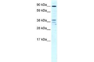 Human Liver; WB Suggested Anti-ZC3H7B Antibody Titration: 4ug/ml. (ZC3H7B Antikörper  (N-Term))