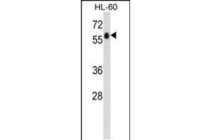 Western blot analysis in HL-60 cell line lysates (35ug/lane). (GPR97 Antikörper  (N-Term))