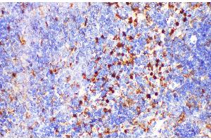 Immunohistochemistry of paraffin-embedded Mouse spleen using LGALS3 Polycloanl Antibody at dilution of 1:200 (Galectin 3 Antikörper)