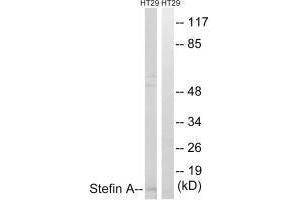 Western blot analysis of extracts from A549 cells, using Stefin A antibody. (CSTA Antikörper  (C-Term))
