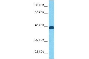 Host:  Rabbit  Target Name:  FOS  Sample Tissue:  Human PANC1 Whole Cell  Antibody Dilution:  1ug/ml (c-FOS Antikörper  (N-Term))