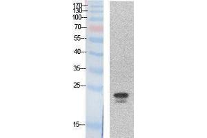 Western Blotting (WB) image for anti-Sex Determining Region Y (SRY) (Internal Region) antibody (ABIN3181048) (SRY Antikörper  (Internal Region))