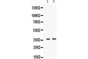 Western blot analysis of SIX1 expression in MCF-7 whole cell lysates (lane 1) and 22RV1 whole cell lysates (lane 2).
