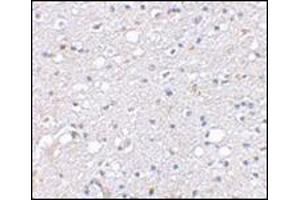 Immunohistochemical staining of human brain tissue using AP30786PU-N at 2. (SIRT2 Antikörper  (N-Term))