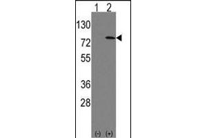 Western Blotting (WB) image for anti-Leo1, Paf1/RNA Polymerase II Complex Component, Homolog (S. Cerevisiae) (LEO1) (AA 130-159), (N-Term) antibody (ABIN388697)