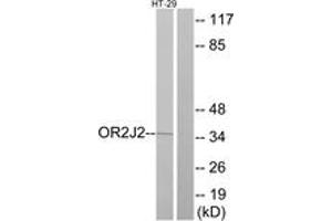 Western blot analysis of extracts from HT-29 cells, using OR2J2 Antibody. (OR2J2 Antikörper  (AA 263-312))