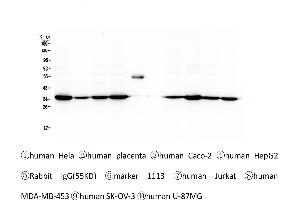 Western blot analysis of Emerin using anti-Emerin antibody . (Emerin Antikörper  (N-Term))