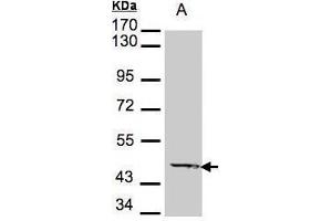WB Image Sample A: 30μg of A431 whole cell lysate , 7. (Medium-Chain Specific Acyl-CoA Dehydrogenase, Mitochondrial (MCAD) (Center) Antikörper)
