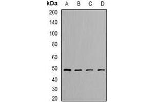 Western blot analysis of DLST expression in SKOV3 (A), Hela (B), mouse kidney (C), rat liver (D) whole cell lysates. (DLST Antikörper)