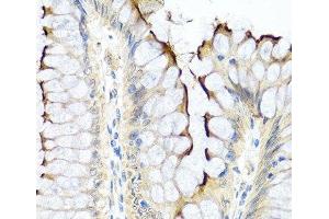 Immunohistochemistry of paraffin-embedded Human colon using INHBC Polyclonal Antibody at dilution of 1:100 (40x lens).