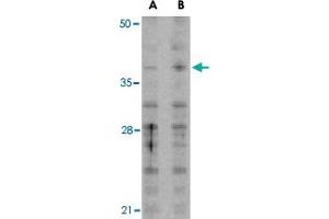 Western blot analysis of MCL1 in Raji cell lysates with MCL1 polyclonal antibody  at (A) 1 and (B) 2 ug/mL . (MCL-1 Antikörper  (N-Term))