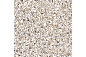 Immunohistochemistry of paraffin-embedded mouse liver using UB Rabbit mAb (ABIN7271128) at dilution of 1:50 (40x lens). (UBA52 Antikörper)