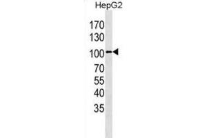 Western Blotting (WB) image for anti-Leucine-Rich Repeat Containing G Protein-Coupled Receptor 5 (LGR5) antibody (ABIN3001607) (LGR5 Antikörper)