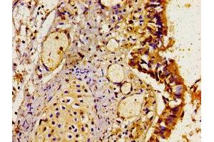 Immunohistochemistry of paraffin-embedded human lung tissue using ABIN7158808 at dilution of 1:100