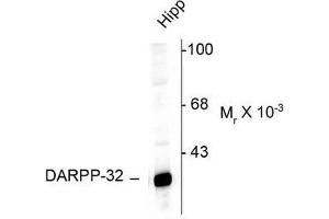 Image no. 1 for anti-Protein Phosphatase 1, Regulatory (Inhibitor) Subunit 1B (PPP1R1B) (N-Term) antibody (ABIN372605) (DARPP32 Antikörper  (N-Term))