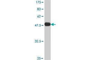 Western Blot detection against Immunogen (50. (ARHGDIG Antikörper  (AA 1-225))