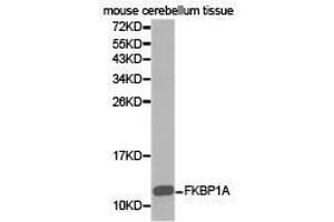 Western Blotting (WB) image for anti-FK506 Binding Protein 1A, 12kDa (FKBP1A) antibody (ABIN1872697) (FKBP1A Antikörper)