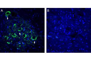 Expression of Connexin-47 in rat spinal cord ventral horn region. (Gap Junction Protein, gamma 2, 47kDa (GJC2) Peptid)