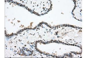 Image no. 1 for anti-Transforming, Acidic Coiled-Coil Containing Protein 3 (TACC3) antibody (ABIN1498099) (TACC3 Antikörper)