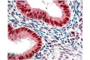 Image no. 1 for anti-Chromobox Homolog 5 (CBX5) (Internal Region) antibody (ABIN374617) (CBX5 Antikörper  (Internal Region))