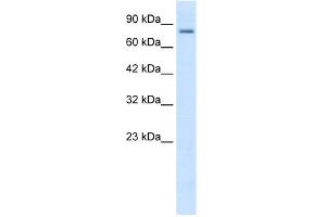 WB Suggested Anti-KCNN3 Antibody Titration:  0. (KCNN3 Antikörper  (C-Term))