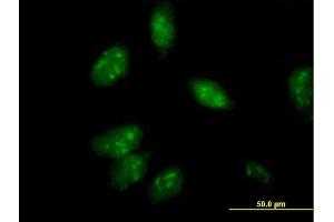 Immunofluorescence of purified MaxPab antibody to ANXA4 on HeLa cell.