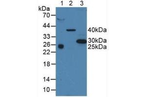 Western blot analysis of (1) Human Serum, (2) Porcine Liver Tissue and (3) Human A375 Cells. (CD63 Antikörper  (AA 103-203))