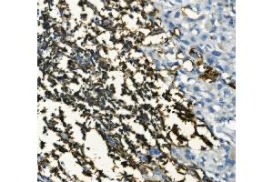 IHC analysis of CD20/MS4A1 using anti-CD20/MS4A1 antibody (ABIN7599233). (CD20 Antikörper  (AA 1-297))