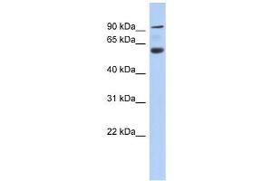 CENTB5 antibody used at 1 ug/ml to detect target protein. (Acap3 Antikörper  (N-Term))