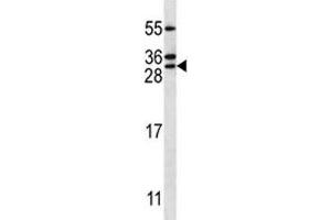 RAB5C antibody western blot analysis in Jurkat lysate.