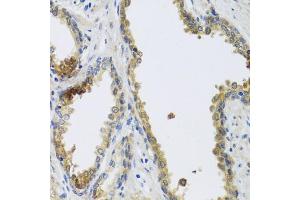 Immunohistochemistry of paraffin-embedded human prostate using GFER antibody. (GFER Antikörper)