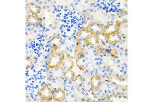 Immunohistochemistry of paraffin-embedded rat kidney using STC1 antibody (ABIN5975425) at dilution of 1/100 (40x lens). (Stanniocalcin 1 Antikörper)