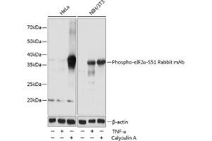 Western blot analysis of extracts of various cell lines, using Phospho-eIF2α-S51 Rabbit mAb (ABIN6135266, ABIN6136152, ABIN6136153 and ABIN7101882) at 1:1000 dilution. (EIF2S1 Antikörper  (pSer51))