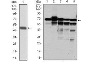Western Blotting (WB) image for anti-Replication Protein A1, 70kDa (RPA1) antibody (ABIN1108896)