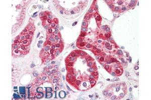 ABIN940551 (5µg/ml) staining of paraffin embedded Human Kidney. (SLC6A8 Antikörper  (Internal Region))