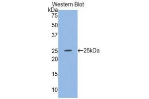 Western Blotting (WB) image for anti-Glutathione Synthetase (GSS) (AA 268-474) antibody (ABIN1859084)