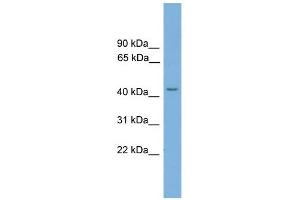 TSPYL6 antibody used at 1 ug/ml to detect target protein. (TSPY-Like 6 Antikörper  (N-Term))