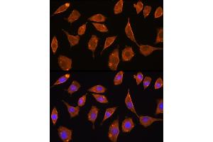 Immunofluorescence (IF) image for anti-Thioredoxin Reductase 2 (TXNRD2) (AA 100-310) antibody (ABIN6149741)