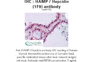 Image no. 1 for anti-Hepcidin Antimicrobial Peptide (HAMP) (AA 25-85), (full length) antibody (ABIN1723595) (Hepcidin Antikörper  (full length))
