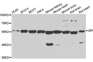 Western blot analysis of extracts of various cell lines, using GPI antibody. (GPI Antikörper)
